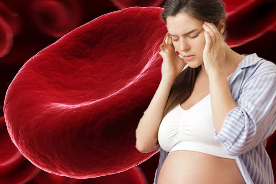 Signs of iron deficiency anemia in pregnant women. Graphics: Thien Nhan