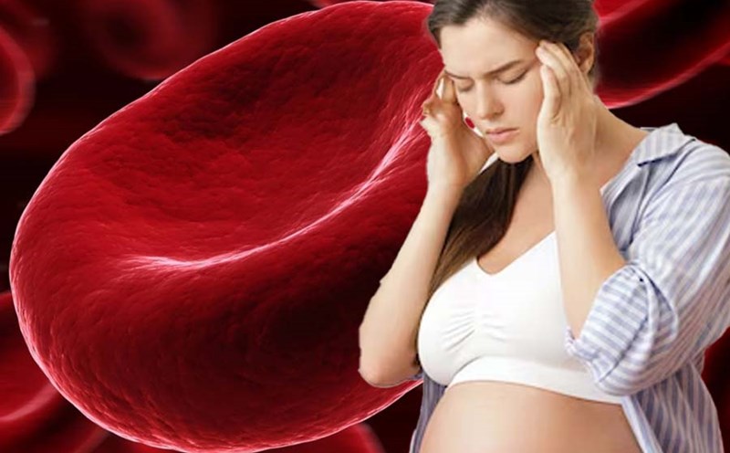 Signs of iron deficiency anemia in pregnant women. Graphics: Thien Nhan