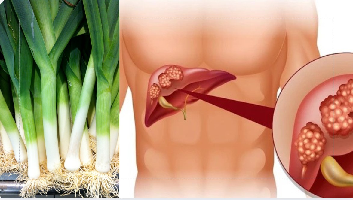 Why leeks are a "superfood" that helps detoxify the kidneys and liver. Graphics: Cao Thom