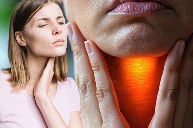 Women are more susceptible to thyroid-related diseases than men. Graphics: Thien Nhan