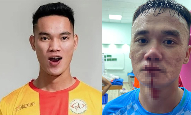 Player Vu Van Son (left) of Ho Chi Minh City Youth and Nguyen Xuan Nam (right) of PVF-CAND fought after the match. Photo: FBNV/PVF-CAND