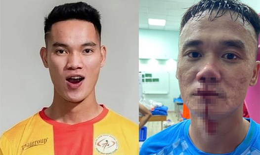 Cầu thủ Vũ Văn Sơn (trái) của Trẻ TPHCM và Nguyễn Xuân Nam (phải) bên phía PVF-CAND đánh nhau sau trận đấu. Ảnh: FBNV/PVF-CAND