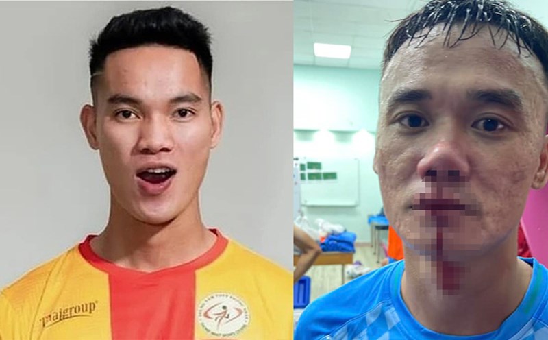 Player Vu Van Son (left) of Ho Chi Minh City Youth and Nguyen Xuan Nam (right) of PVF-CAND fought after the match. Photo: FBNV/PVF-CAND
