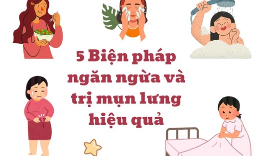 5 Biện pháp ngăn ngừa và trị mụn lưng hiệu quả. Đồ họa: Kim Thủy