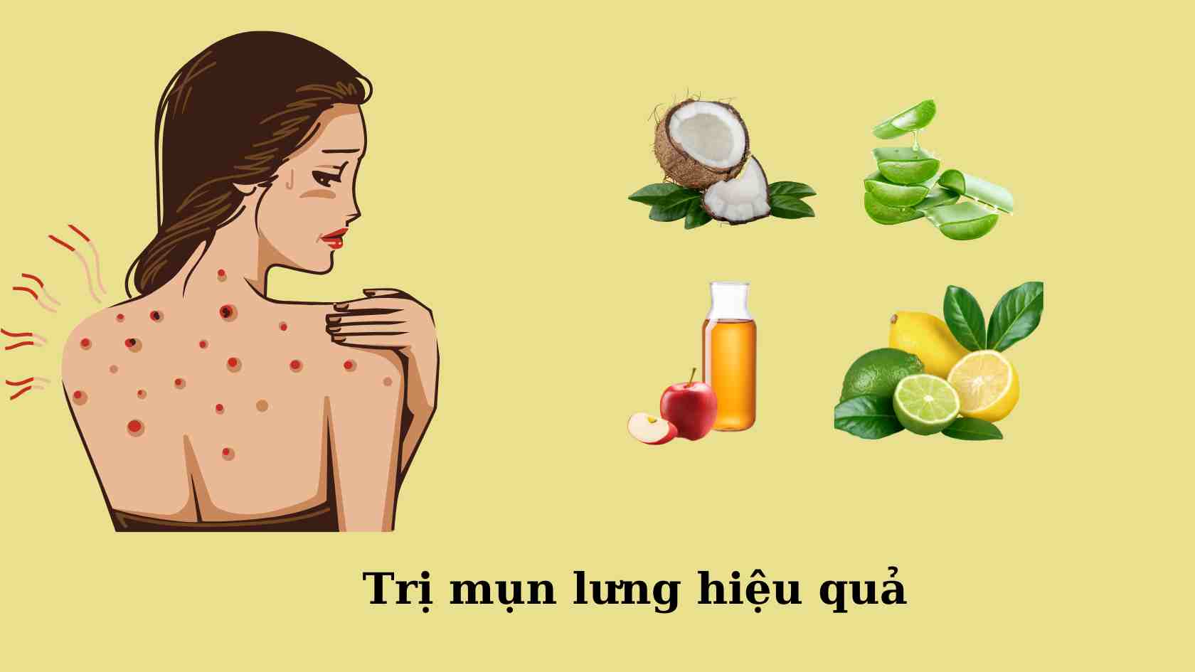 Easy-to-find products that effectively treat back acne. Graphics: Khanh Linh