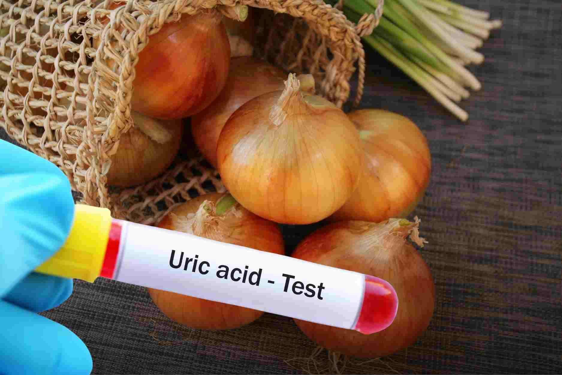 How to prepare onions to help limit uric acid spikes