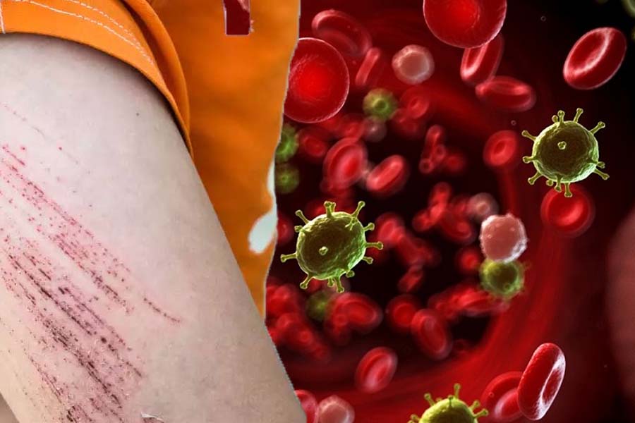 If sepsis is not detected and treated promptly, it will cause serious health complications. Graphics: Thien Nhan