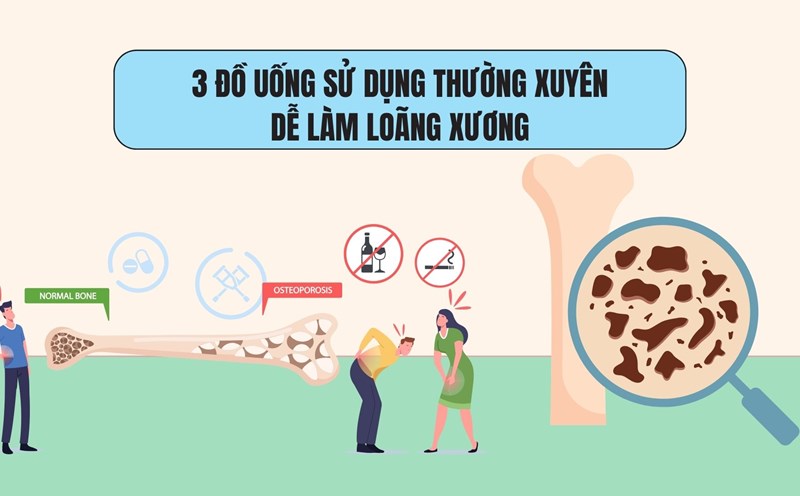 3 drinks that are used regularly can easily cause osteoporosis