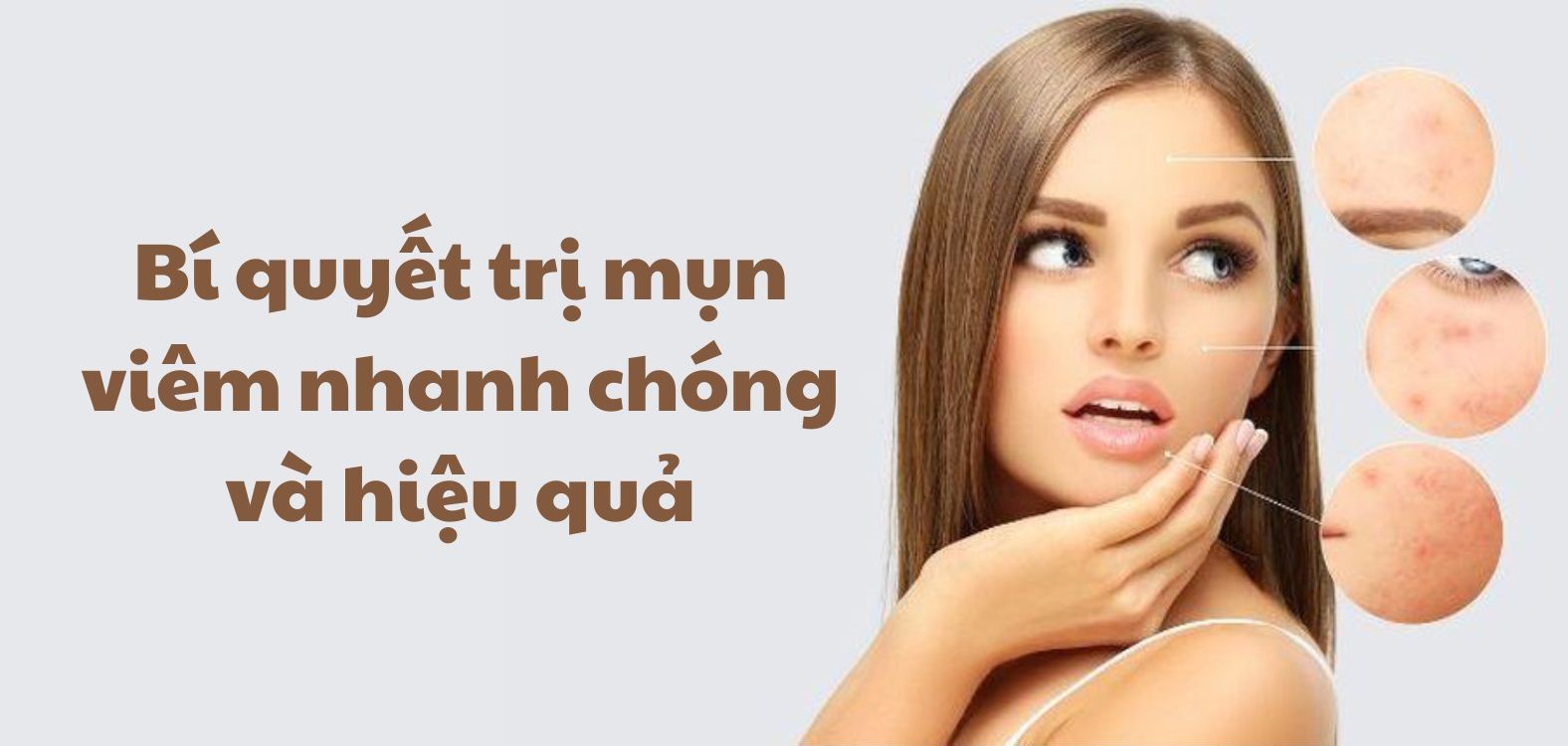 Secret to treat acne quickly and effectively. Graphics: Kim Thuy