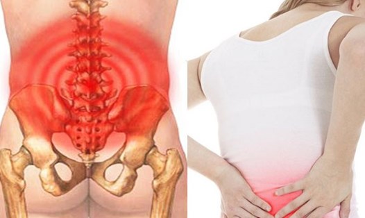 Phụ nữ dễ bị đau lưng dưới hơn so với nam giới. Đồ họa: Hương Sơn