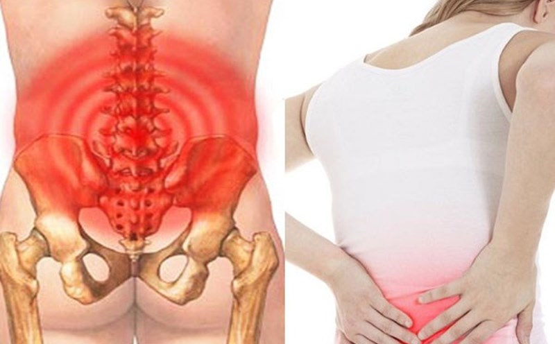Women are more susceptible to lower back pain than men. Graphics: Huong Son