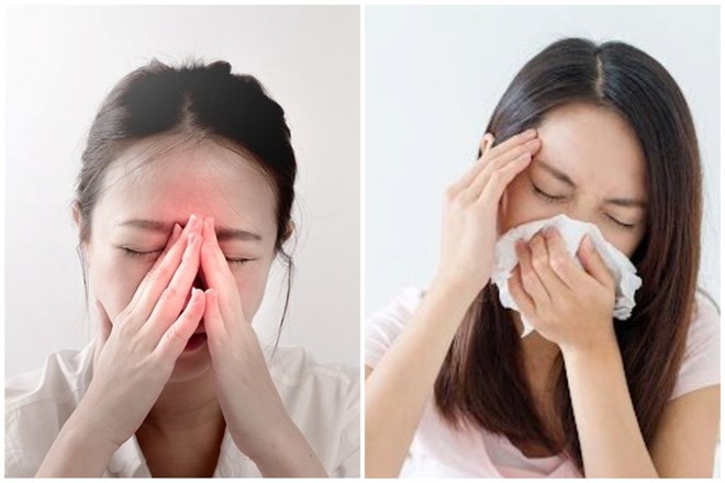 Treatment to reduce sinusitis symptoms when the weather changes. Graphics: Thanh Thanh