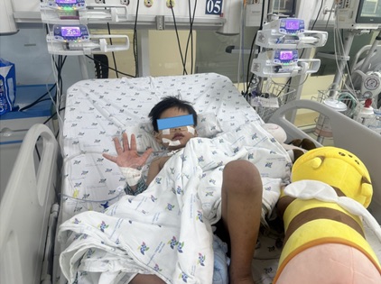 A child with dengue fever was successfully treated. Photo: Provided by the doctor