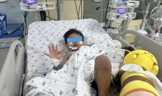 Bệnh nhi mắc sốt xuất huyết được điều trị thành công. Ảnh: Bác sĩ cung cấp