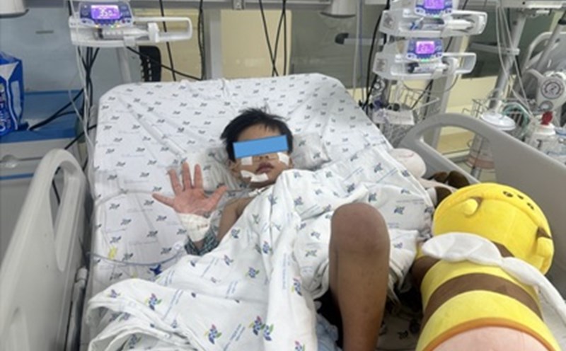A child with dengue fever was successfully treated. Photo: Provided by the doctor