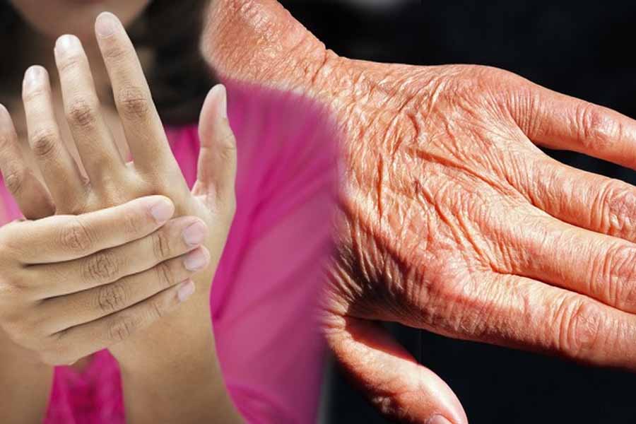 Causes of scleroderma. Graphics: Thien Nhan