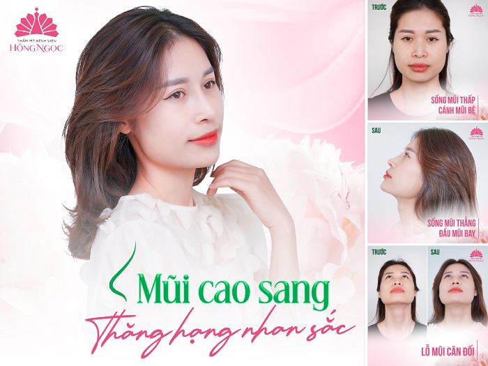 Nang mui Han Quoc dep sang, tinh te, khac phuc moi khuyet diem. Anh: TM BVHN
