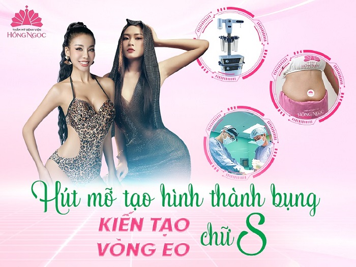 So huu vong eo “that day lung ong” voi hut mo tao hinh thanh bung voi cong nghe Vaser Lipo hien dai tai Tham my Benh vien Hong Ngoc. Anh: TM BVHN
