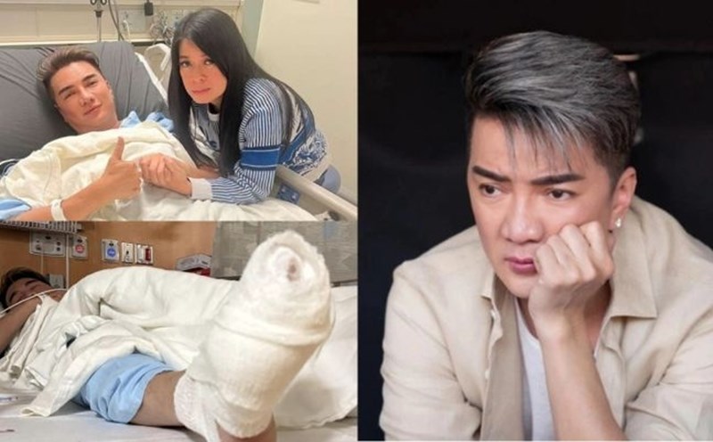 Dam Vinh Hung had an accident and lost several toes. Photo: Screenshot, provided by the artist.