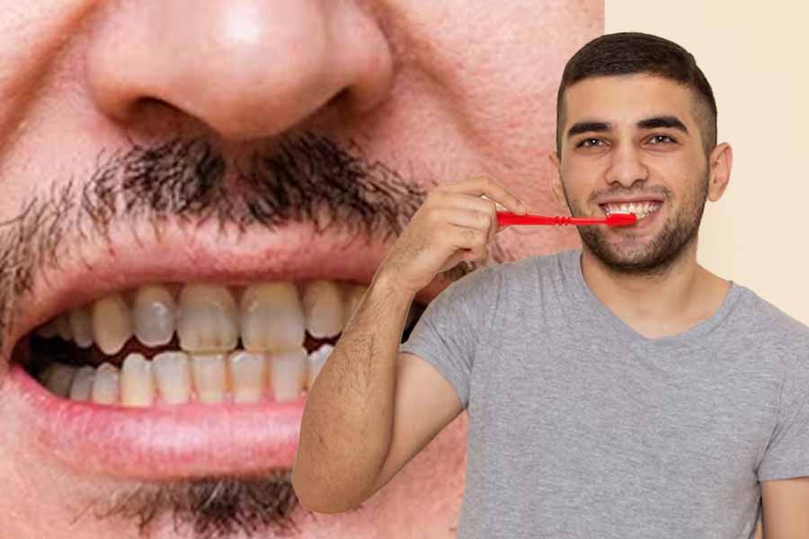 Your lifestyle can affect the color of your teeth. Graphics: Thien Nhan