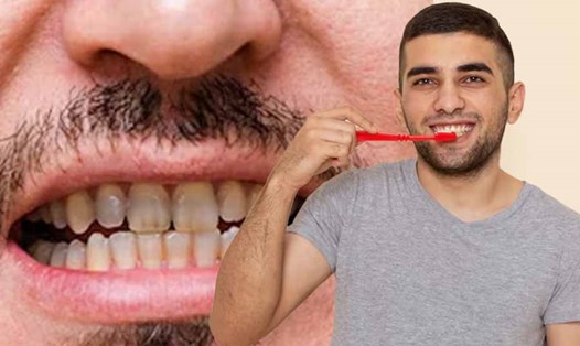 Lối sống của bạn có thể ảnh hưởng đến màu sắc của răng. Đồ hoạ: Thiện Nhân