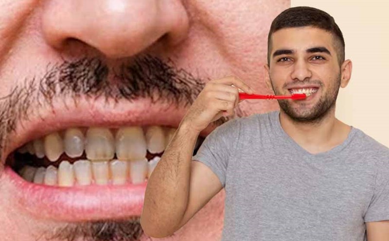 Your lifestyle can affect the color of your teeth. Graphics: Thien Nhan