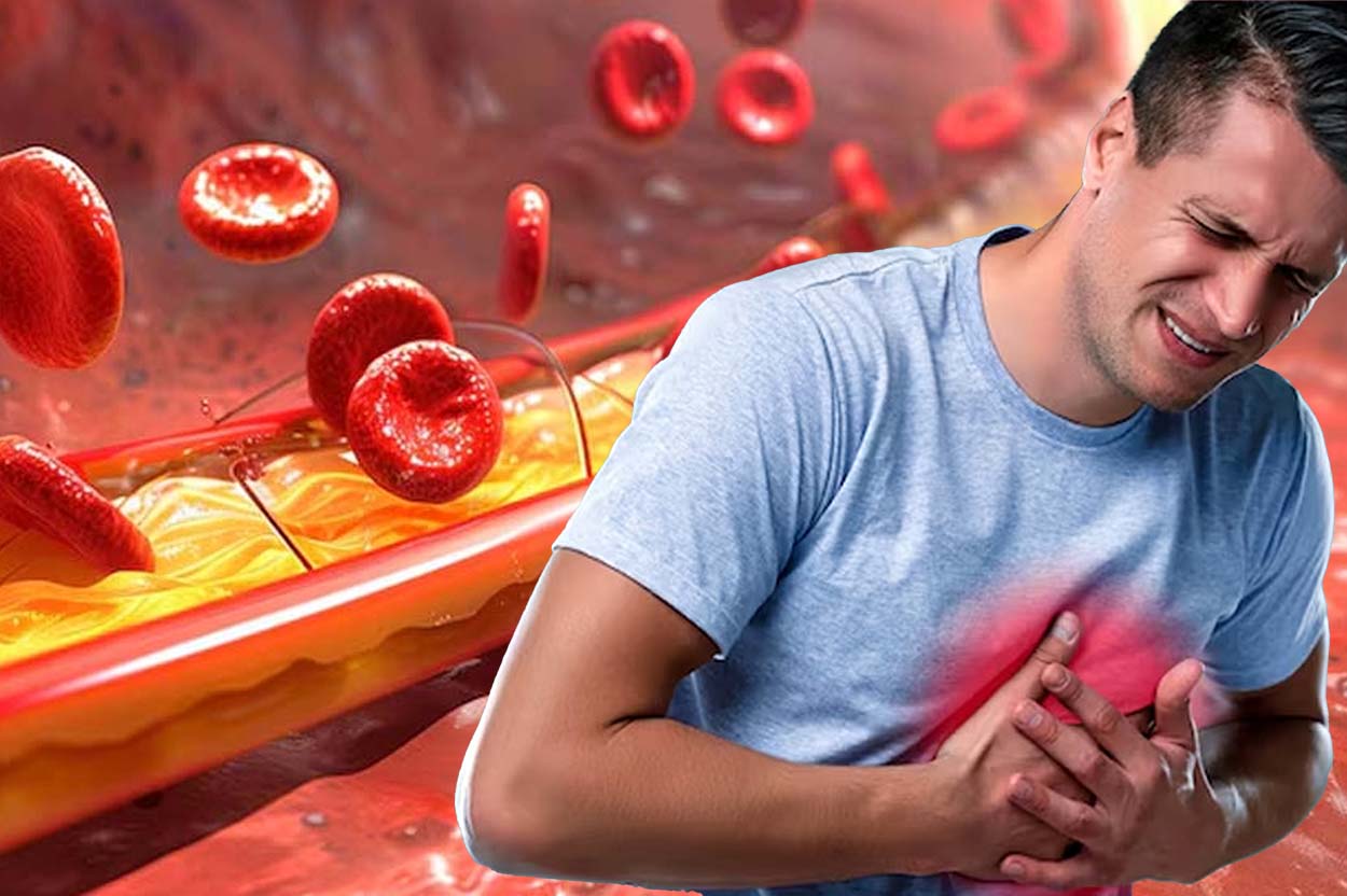 Changing your diet can help prevent clogged arteries. Graphics: Thien Nhan