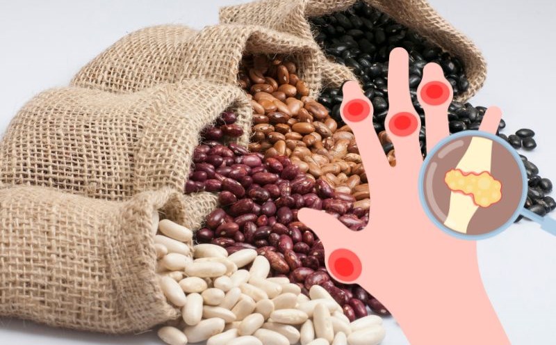People with high uric acid should eat beans properly. Graphics: Ha May