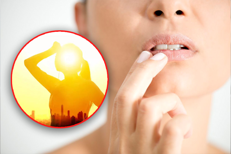 How to prevent and treat sunburned lips. Graphics: Tuan Anh.