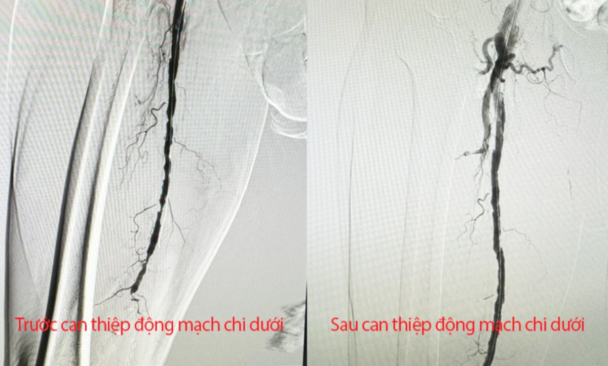 Anh: Benh vien cung cap