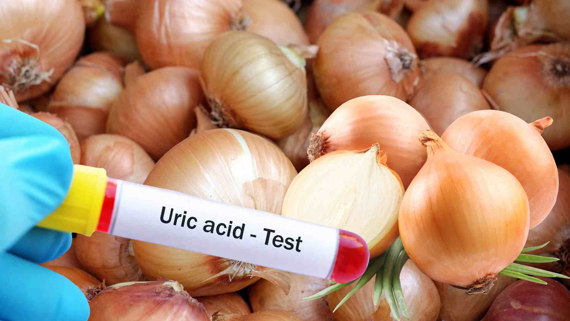 How to control uric acid spike with onions. Graphic photo: Khanh Ngoc
