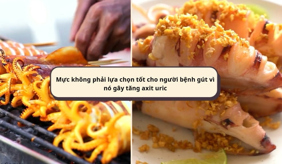 Note when eating squid to avoid increasing uric acid. Graphics: Huong Giang