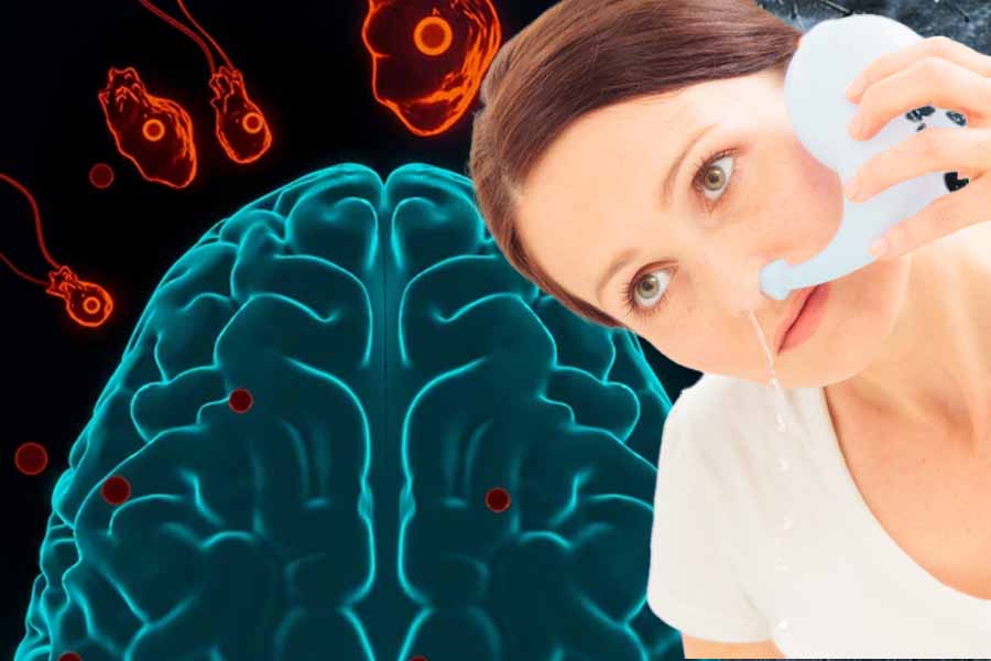 Rinsing your nose with unsterilized tap water can pose many potential health risks. Graphics: Thien Nhan