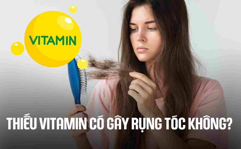 Does vitamin deficiency cause hair loss? Graphics: Cao Thom