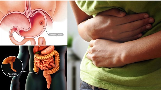 Adopting a few helpful measures can help make a difference to your gut in just two weeks. Graphics: Thieu Phuong