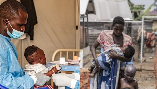 "Mysterious" disease causes many people to get sick and die in the Democratic Republic of Congo. Graphics: Huong Giang