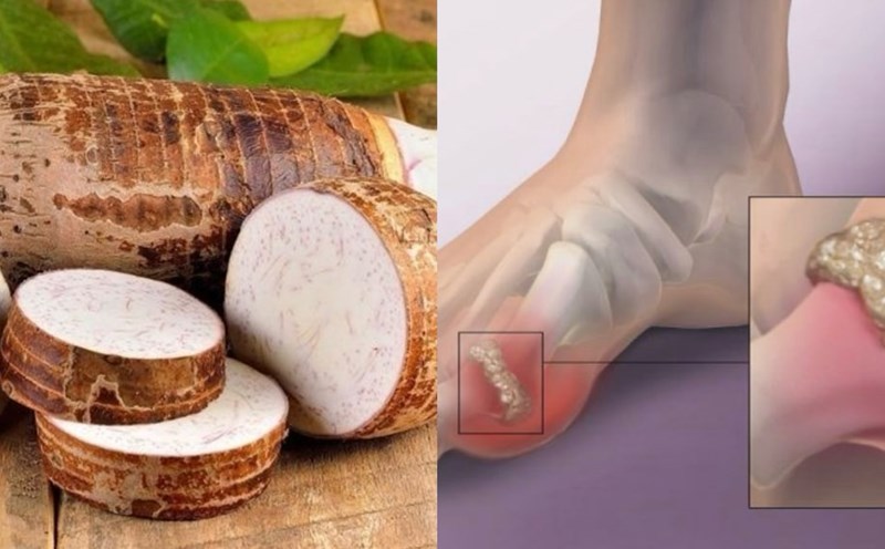 Be careful when eating taro because it can increase uric acid. Graphics: Huong Giang