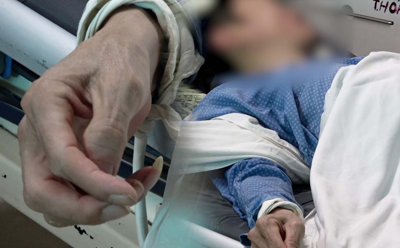 Male patient with alcohol addiction causes cirrhosis, dangerous bleeding