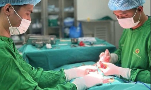 Bác sĩ thực hiện phẫu thuật ca bệnh cong dương vật. Ảnh: BVCC