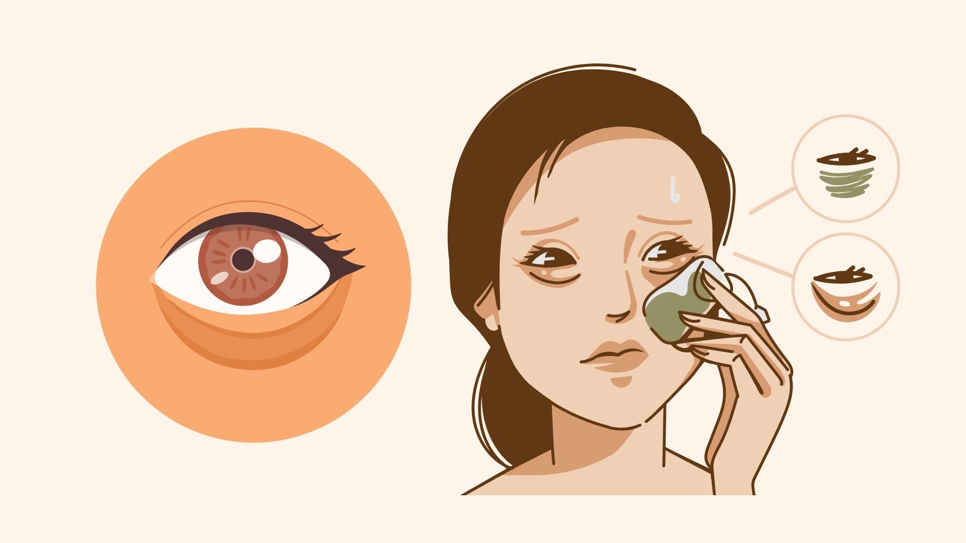 7 possible causes of dark circles under your eyes. Graphics: Dinh Dinh