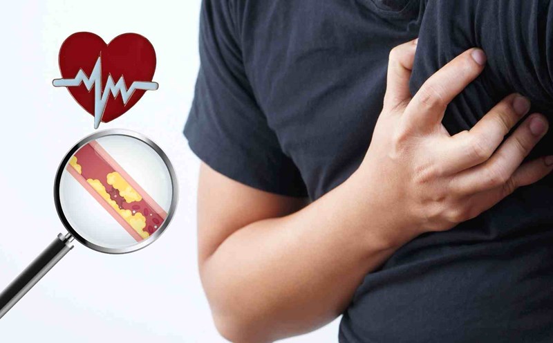 Some signs after exercise signal myocardial infarction, stroke. Graphics: Ha May