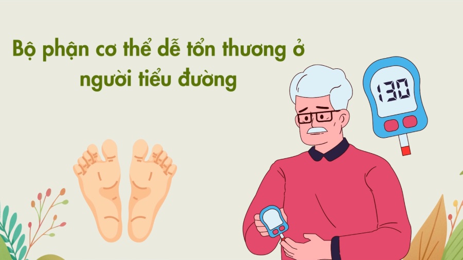 Vulnerable body parts in people with diabetes. Graphics: Phuong Anh