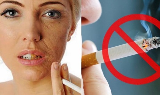 Thuốc lá là kẻ thù thầm lặng của làn da. Đồ họa: Hương Giang
