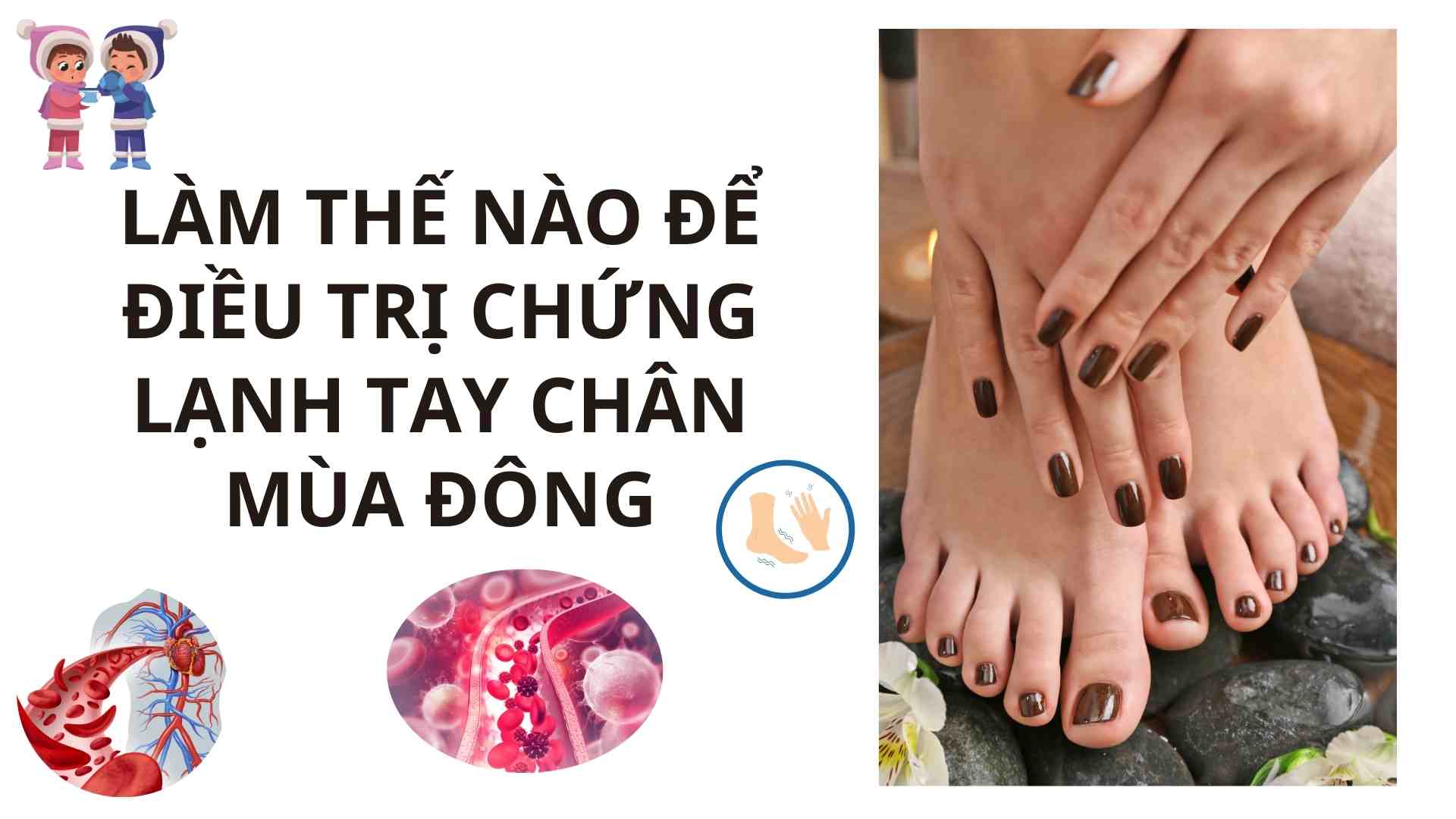 How to treat cold hands and feet in winter. Graphics: Cao Thom