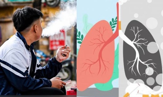 Người trẻ dễ chuyển sang thuốc lá điếu vì thuốc lá mới. Đồ họa: Hương Giang