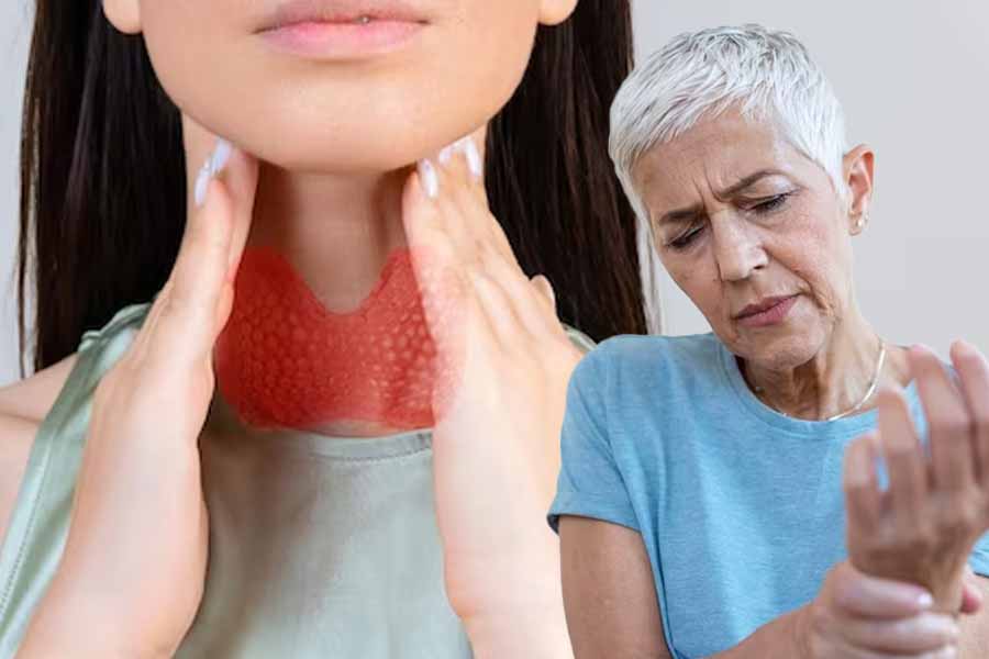 The link between thyroid disorders and joint pain. Graphics: Thien Nhan