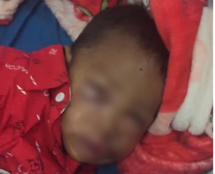 Boy Ro Mah Dung suffered serious facial injuries and had to be rushed to the emergency room. Photo: Thanh Tuan