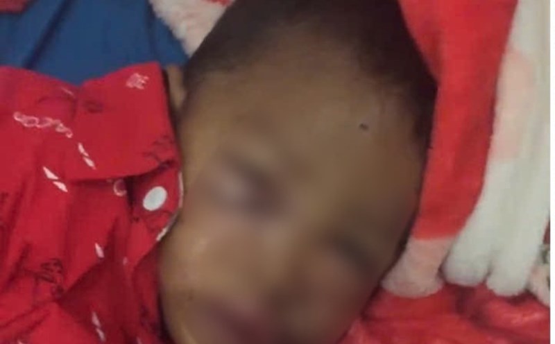 Boy Ro Mah Dung suffered serious facial injuries and had to be rushed to the emergency room. Photo: Thanh Tuan