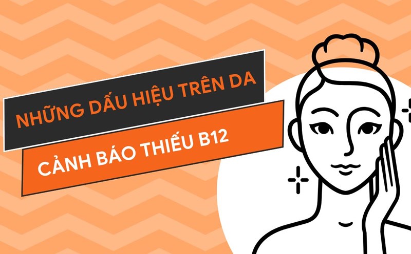 Pale or yellow skin is a sign of vitamin B12 deficiency. Photo collage: HUONG SON