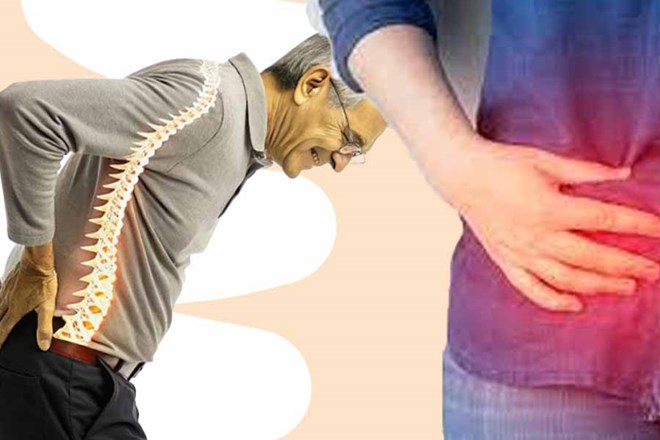 Mối liên hệ giữa bệnh crohn và đau lưng